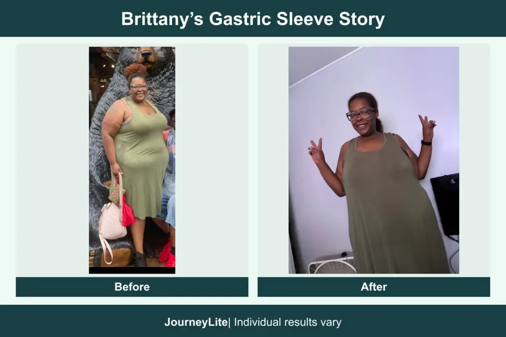 Brittany before and after gastric sleeve surgery, using patient-submitted photos