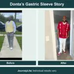 Donta before and after gastric sleeve surgery, using patient-submitted photos