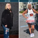 Valerie before and after her weight loss journey with gastric sleeve surgery and later medication support