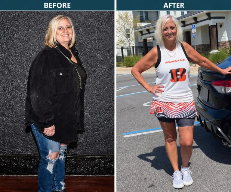 Valerie before and after her weight loss journey with gastric sleeve surgery and later medication support