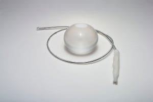 Uninflated and inflated gastric balloon.