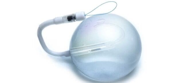 spatz gastric balloon FAQ