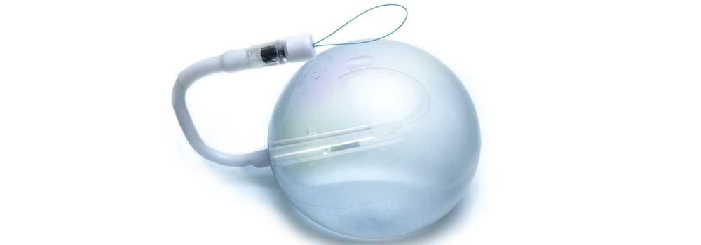 spatz gastric balloon FAQ