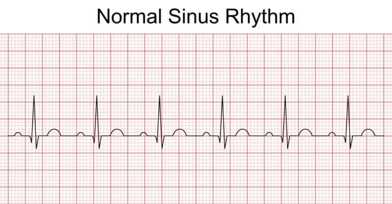 pre-op-ekg-requirements-for-journeylite-surgery-center-find-surgical