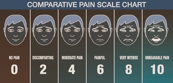 pain scale