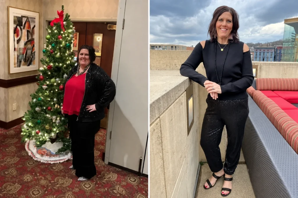 Jenny before and after gastric sleeve surgery showing her more than 200-pound weight-loss result at JourneyLite