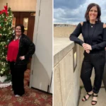 Jenny before and after gastric sleeve surgery showing her more than 200-pound weight-loss result at JourneyLite