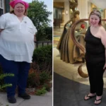 Julie before and after gastric sleeve surgery showing her 202-pound weight-loss result at JourneyLite
