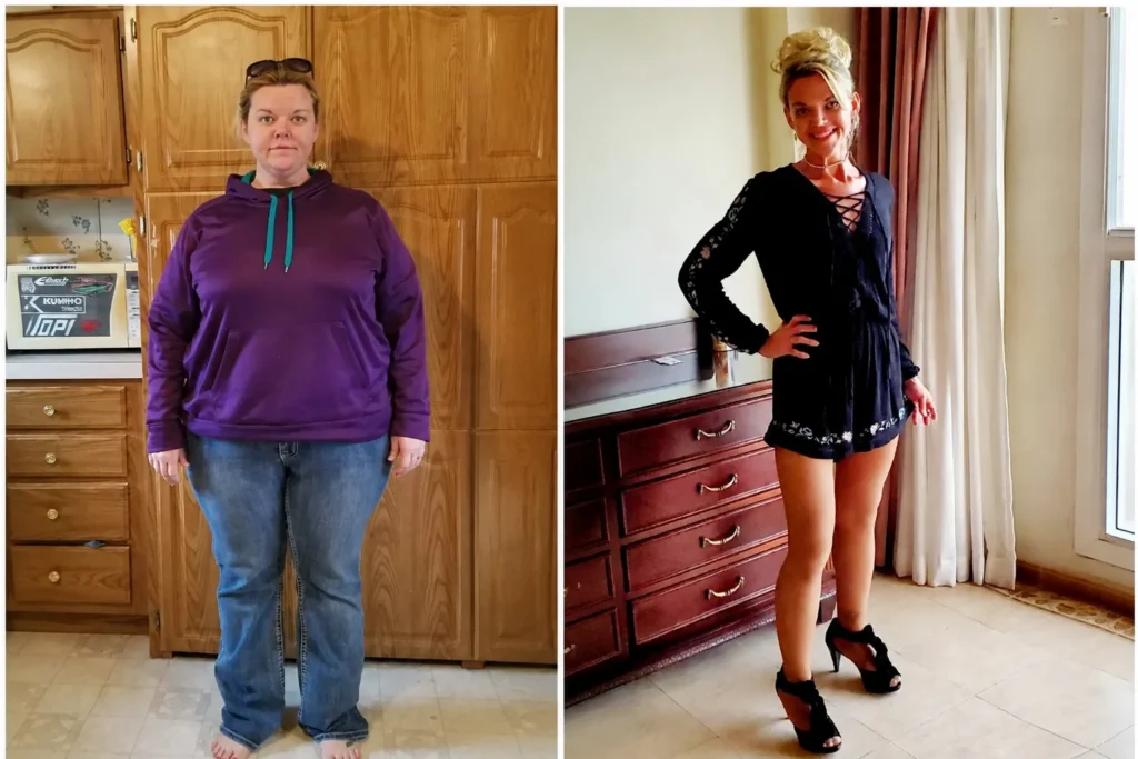 Tracy before and after gastric sleeve surgery showing her 190-pound weight loss at JourneyLite