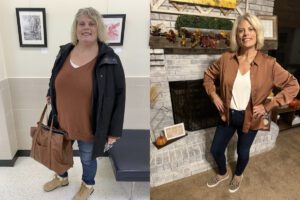 Christie's VSG before and after pictures