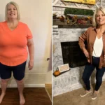 Christie before and after gastric sleeve surgery showing her 136-pound weight loss at JourneyLite