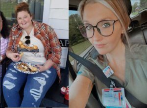 Katy's VSG before and after pic
