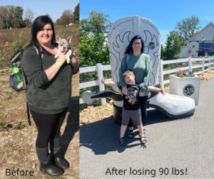 Jamie lost 90 lbs with vsg at JourneyLite