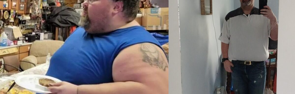 jonathon before and after gastric sleeve (VSG)