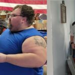 jonathon before and after gastric sleeve (VSG)