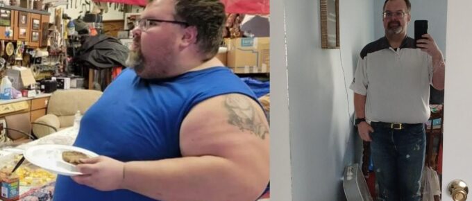 jonathon before and after gastric sleeve (VSG)