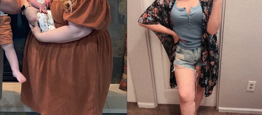 callie before and after losing 187 pounds with gastric sleeve surgery