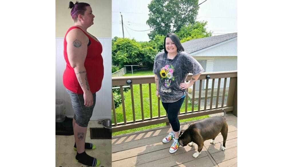 Heidi before and after gastric sleeve surgery