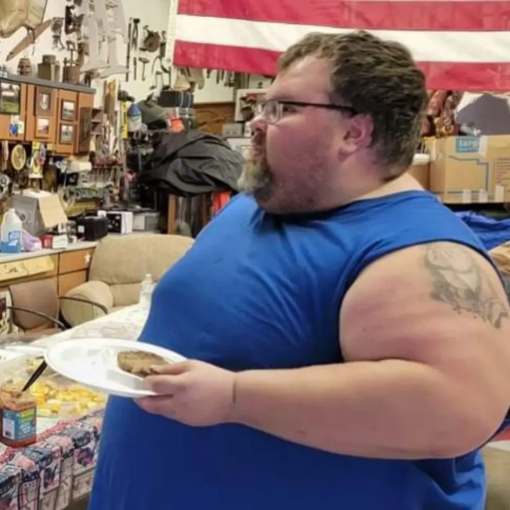 jonathon before gastric sleeve (VSG)