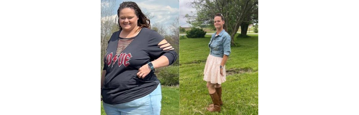 kristin's gastric bypass before and after featured image