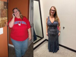 rebecca before and after vsg