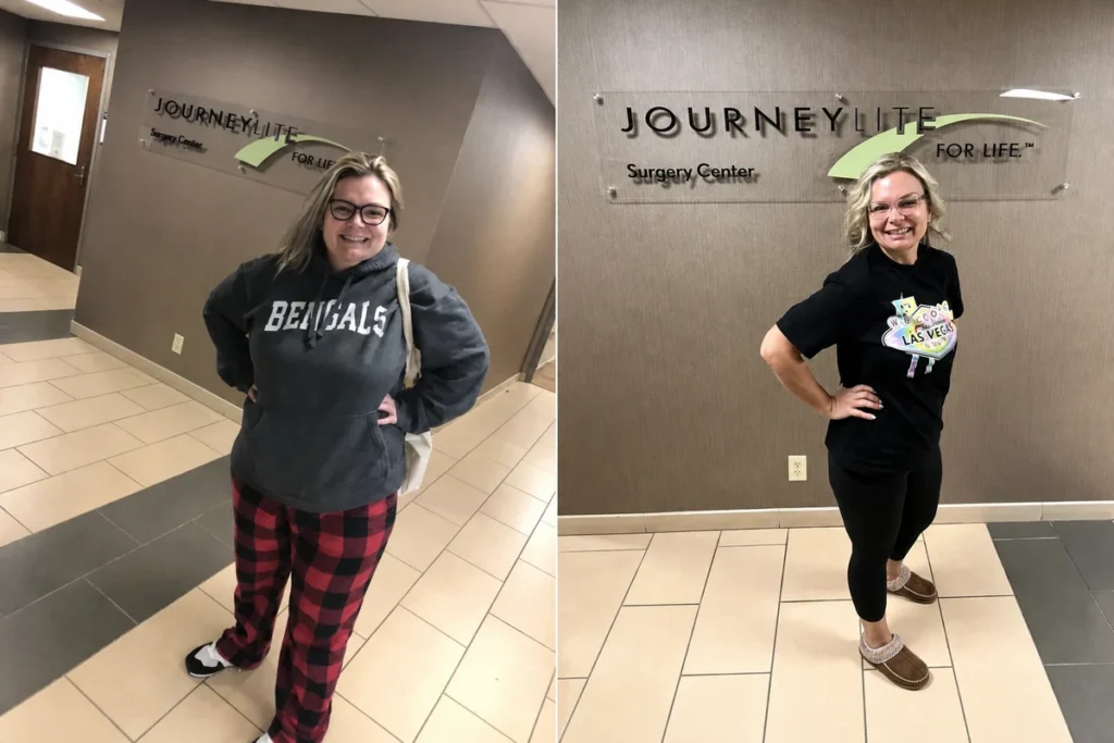 Jennifer before and after gastric sleeve surgery showing her 125-pound weight-loss result at JourneyLite