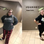Jennifer before and after gastric sleeve surgery showing her 125-pound weight-loss result at JourneyLite