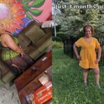 Alona VSG before and after