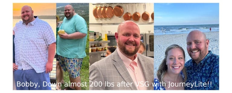 Bobby before and after gastric sleeve surgery