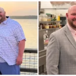 Bobby before and after gastric sleeve surgery showing his 197-pound weight loss at JourneyLite