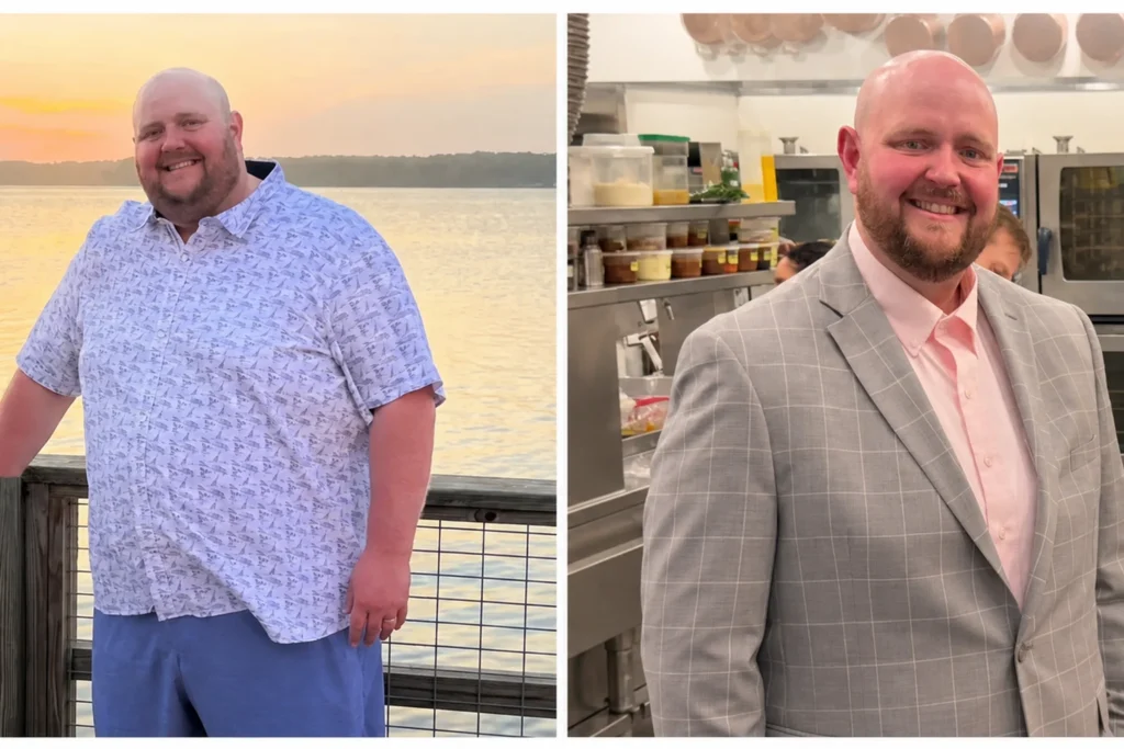 Bobby before and after gastric sleeve surgery showing his 197-pound weight loss at JourneyLite