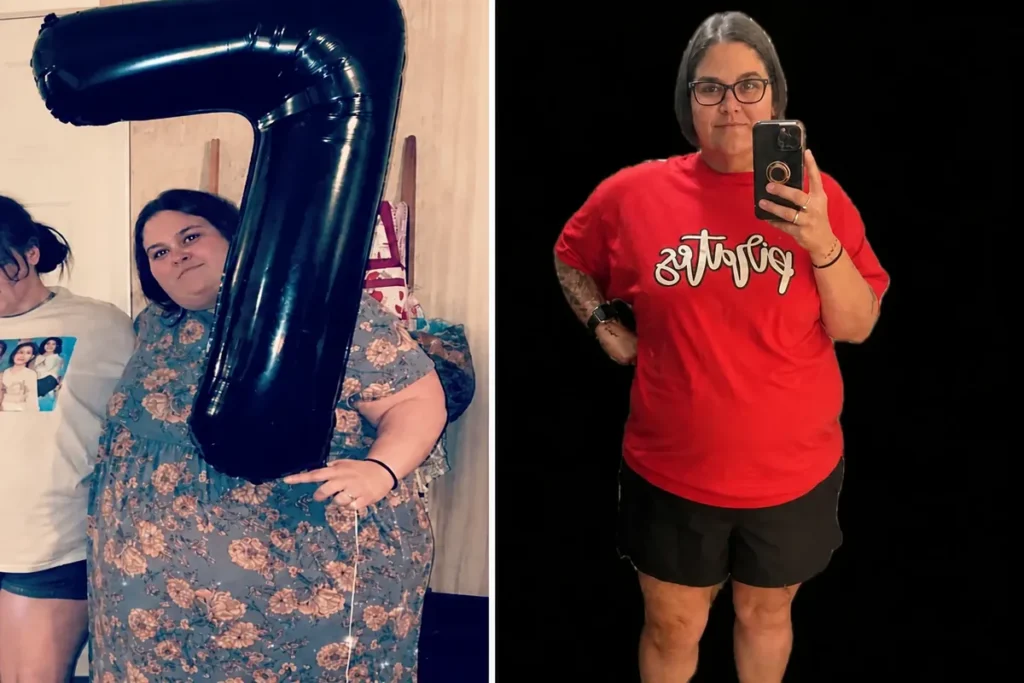 Mindy before and after gastric sleeve surgery showing her 161-pound weight loss at JourneyLite