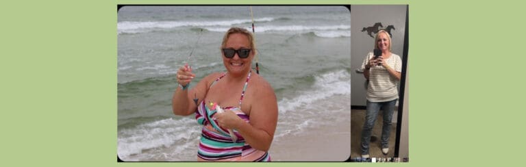 Kandace before and after gastric sleeve surgery