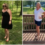 Kandace before and after gastric sleeve surgery showing her 96-pound weight loss at JourneyLite