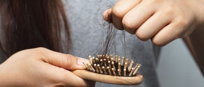 Patient brushing hair—temporary post-bariatric hair shedding (telogen effluvium)”