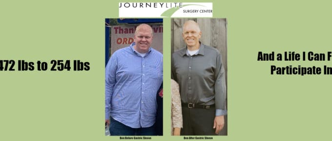 Ben’s gastric sleeve success at JourneyLite—before at 472 lbs and after at 254 lbs, side-by-side.
