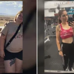 Chrissy before and after gastric sleeve surgery showing her 115-pound weight loss at JourneyLite