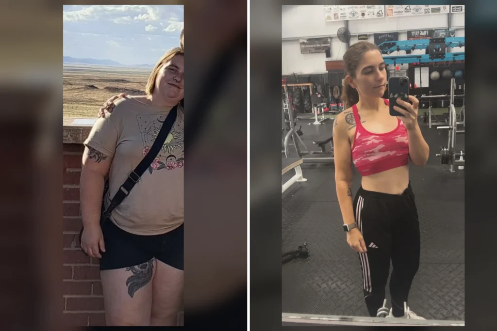 Chrissy before and after gastric sleeve surgery showing her 115-pound weight loss at JourneyLite
