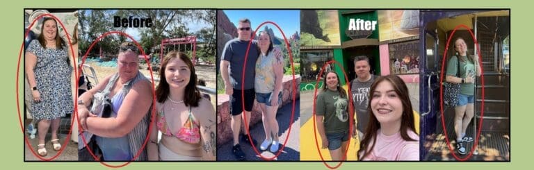 Heather before and after weight loss surgery