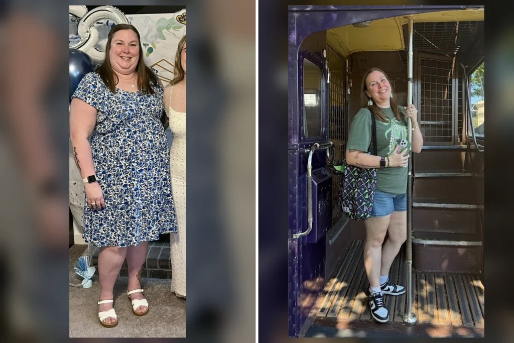 Heather before and after gastric bypass surgery showing her 94-pound weight loss at JourneyLite