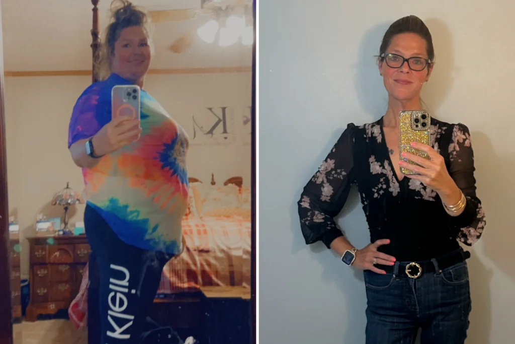 Kelly before and after gastric sleeve surgery showing her 232-pound weight loss at JourneyLite