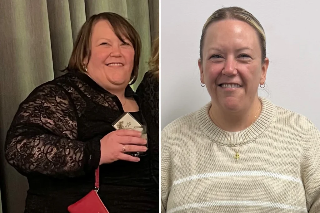 Leslie before and after gastric sleeve surgery showing her 112-pound weight loss at JourneyLite