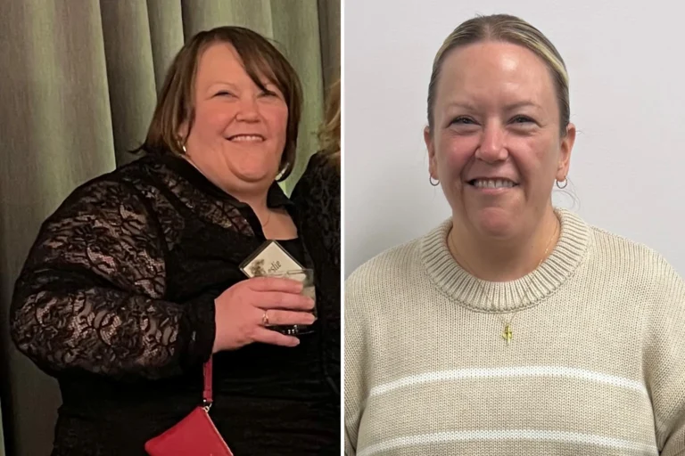 Leslie before and after gastric sleeve surgery showing her 112-pound weight loss at JourneyLite