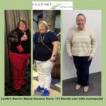 Leslie’s three-panel before-and-after photo showing her 112-pound weight loss after gastric sleeve surgery with Dr. James Augusta at JourneyLite Surgery Center.