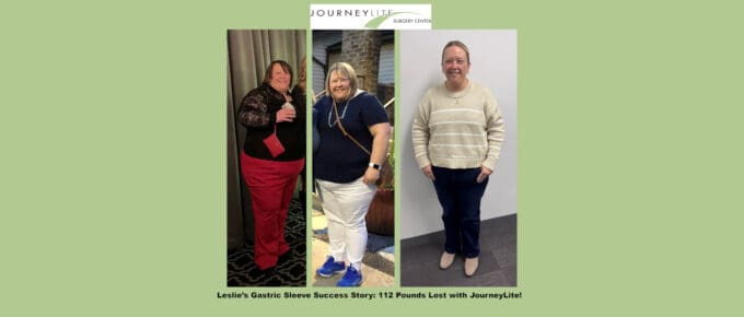 Leslie’s three-panel before-and-after photo showing her 112-pound weight loss after gastric sleeve surgery with Dr. James Augusta at JourneyLite Surgery Center.
