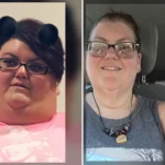 Robin before and after gastric bypass surgery showing her 180-pound weight loss at JourneyLite