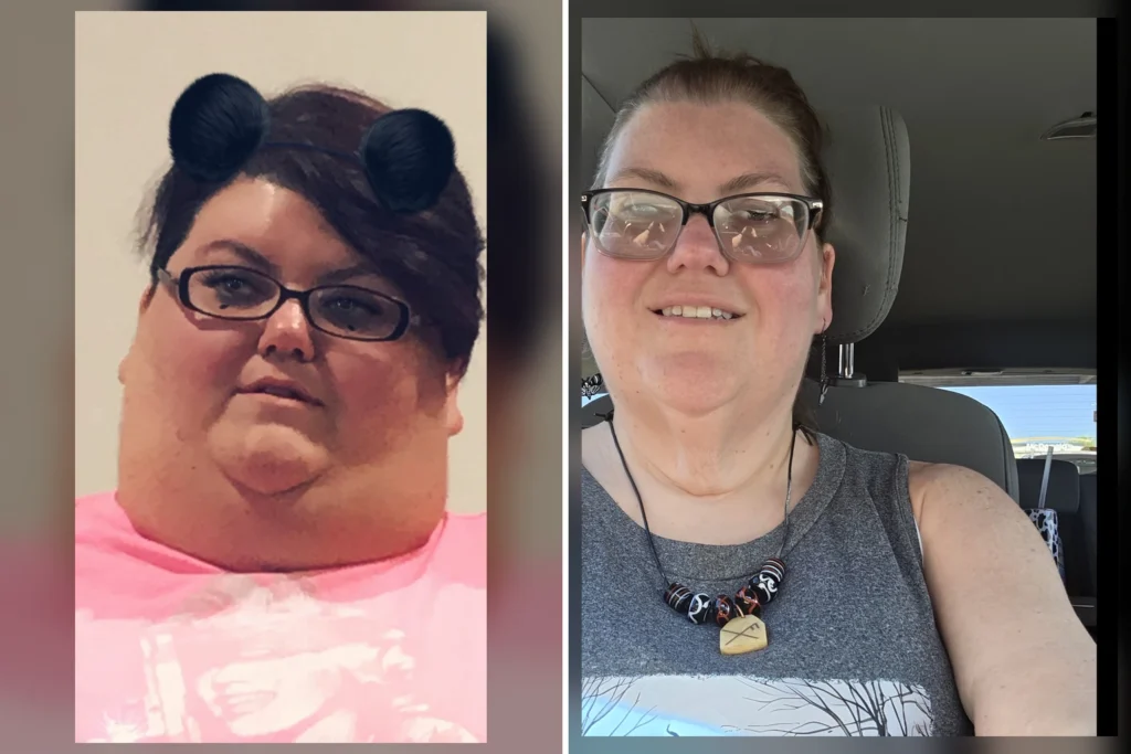 Robin before and after gastric bypass surgery showing her 180-pound weight loss at JourneyLite