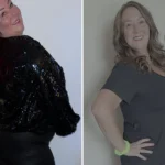 Tina before and after gastric sleeve surgery showing her 88-pound weight loss at JourneyLite