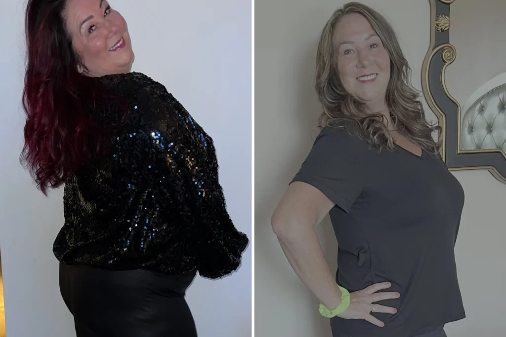 Tina before and after gastric sleeve surgery showing her 88-pound weight loss at JourneyLite