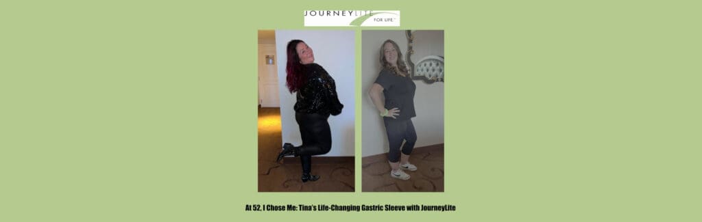 Side-by-side before-and-after photo of Tina, a JourneyLite gastric sleeve patient, showing her weight loss and increased confidence as she poses in a sparkly black outfit and fitted athletic wear after surgery with Dr. James Augusta at JourneyLite